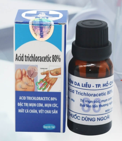 Chấm mụn cóc acid trichloracetic