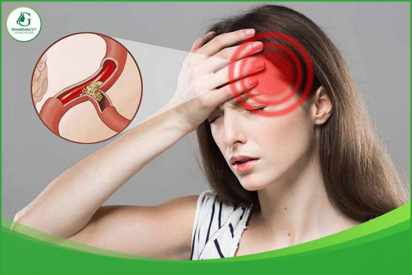 NHỮNG NGUYÊN NHÂN THIẾU MÁU NÃO CÓ THỂ BẠN CHƯA BIẾT