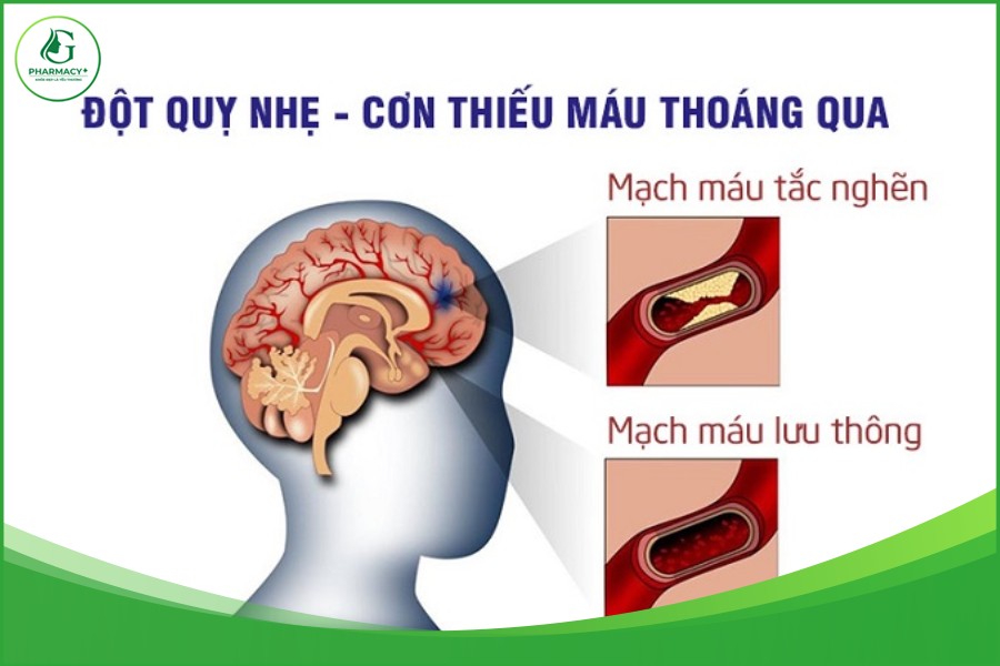 trieu chung dot quy nhẹ