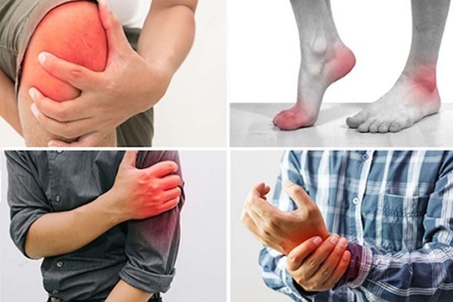 Đau khớp gối là bệnh gì
