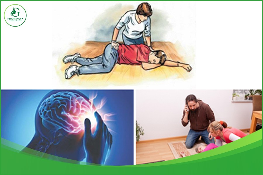 Cách sơ cứu đột quỵ và những sai lầm thường gặp